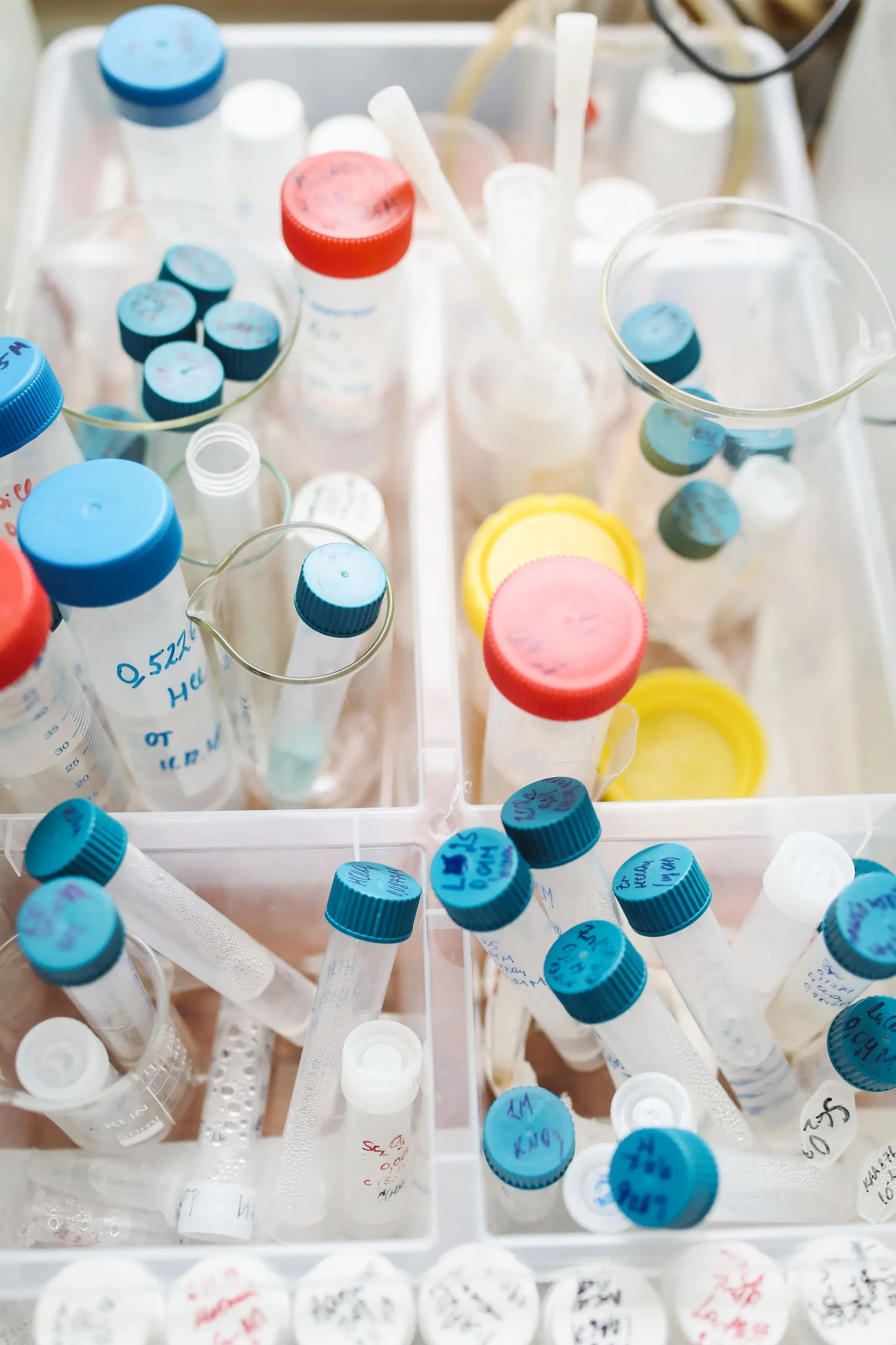 A crowded tray of tubes and pipettes taking the whole bench.